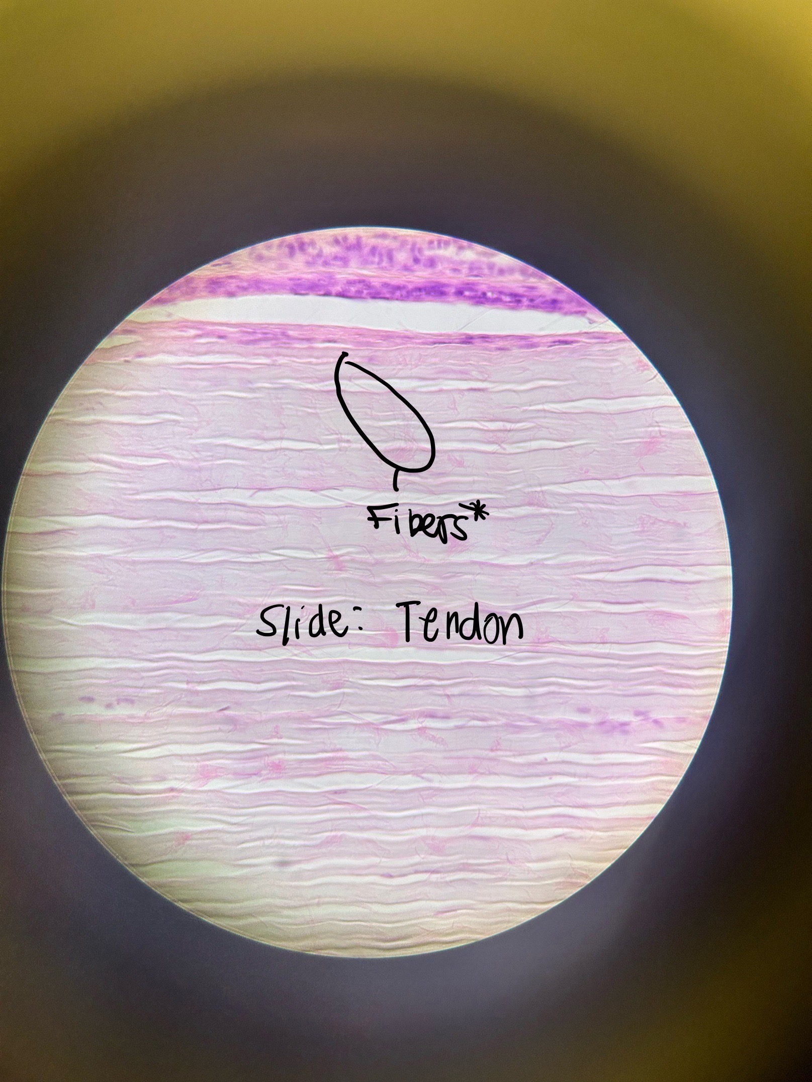 <p>Dense Connective Tissue: Dense Regular CT Location and Function </p>