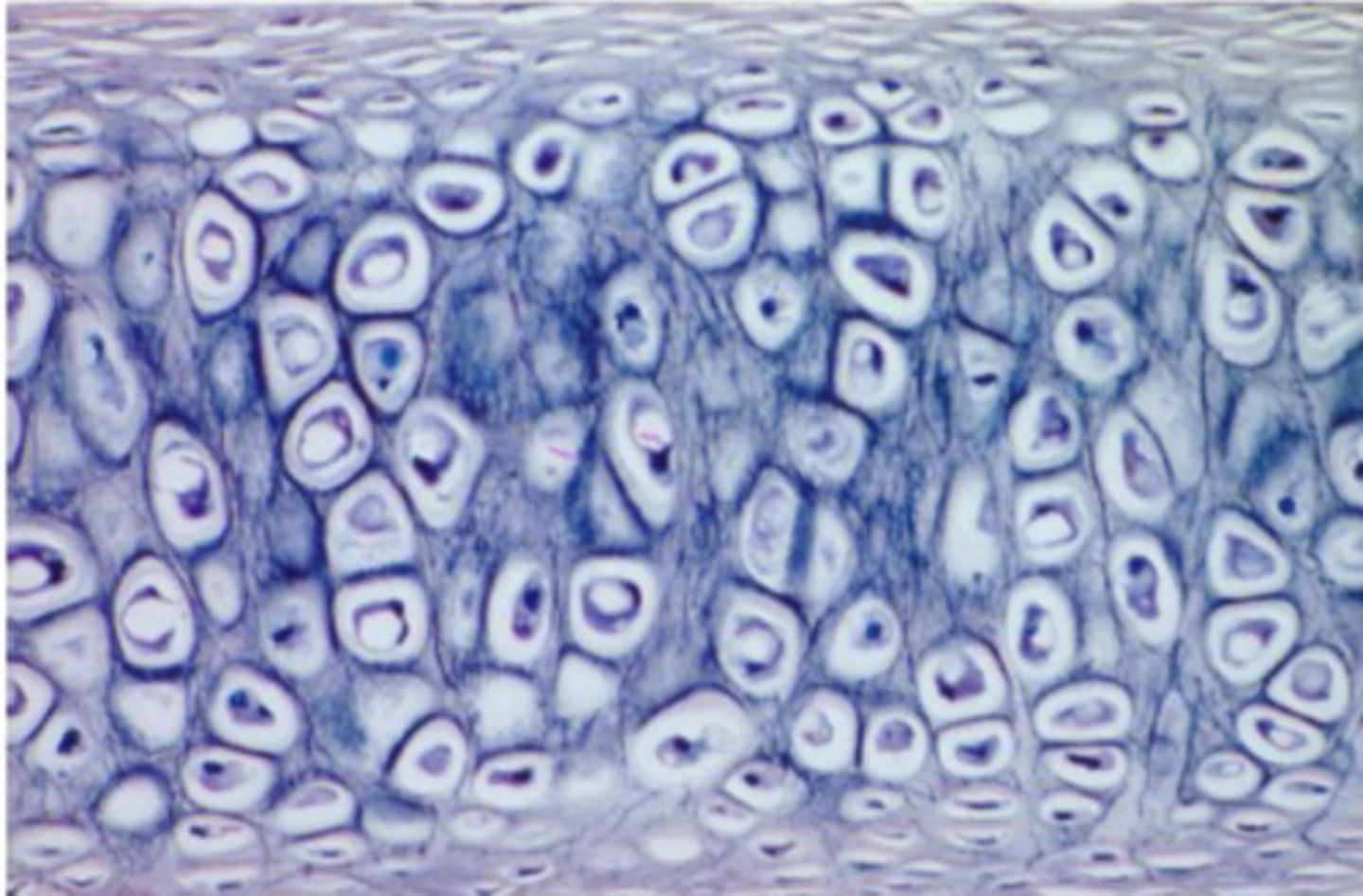<p>cartilage with abundant elastic fibers; more flexible than hyaline cartilage</p>