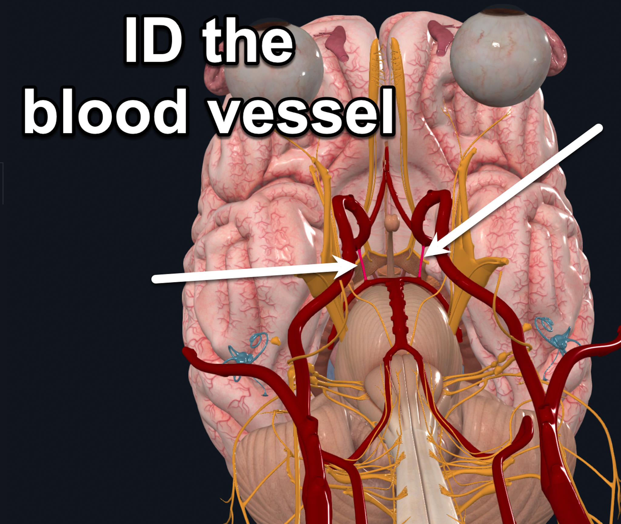term image