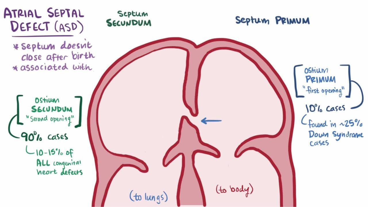<p>gap in the middle, inadequate formation of the septum secundum so that it doesnt completely cover the ostium secundum </p>