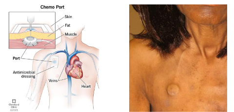 <p>DH Considerations Chemotherapy</p>