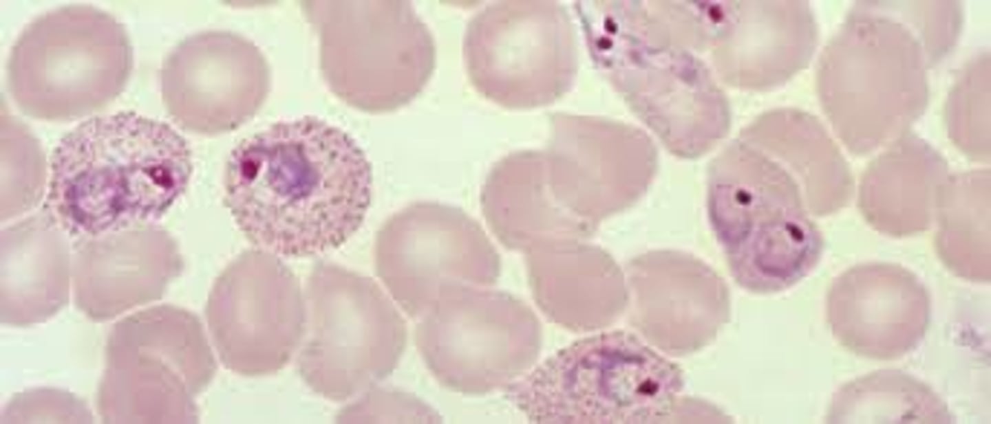 <p>The most frequent and widely distributed cause of recurring malaria. This peripheral blood film depicts which organism?</p>