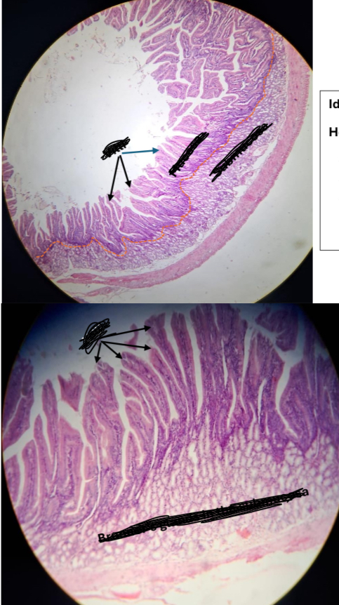 <p>What are Brunner's glands associated with?</p>