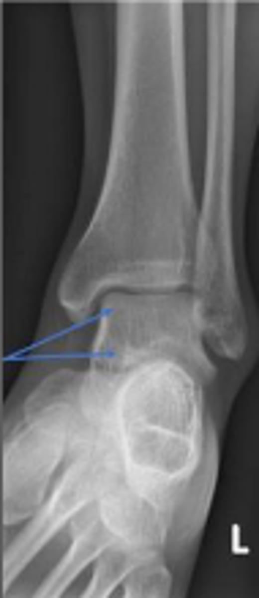 <p>What are the arrows pointing to?</p>