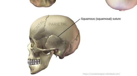 <p>Boundary between parietal and temporal</p>