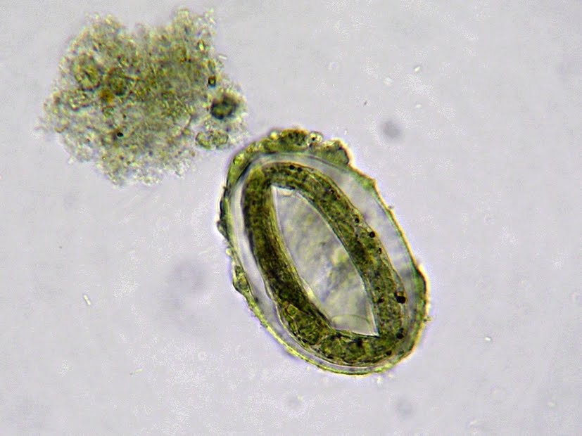 <p>Strongyloides ransomi</p>