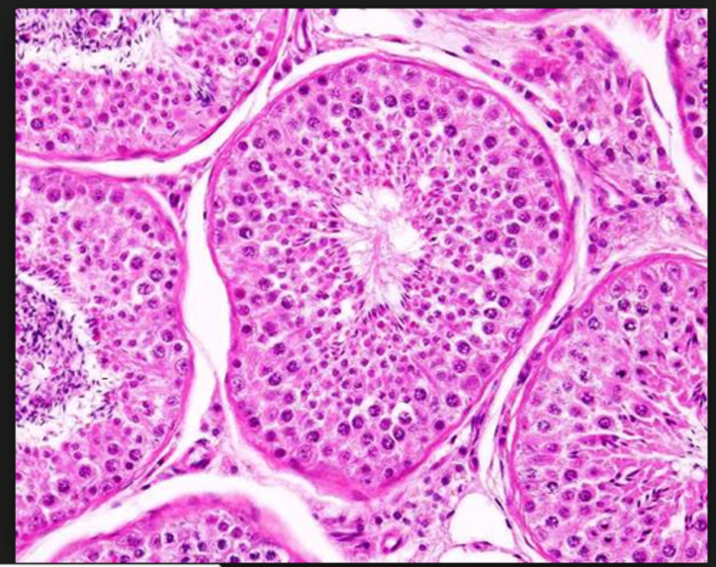 <p>densely cellular tubules confined in the tunica albuginea. They are the site for sperm production</p>