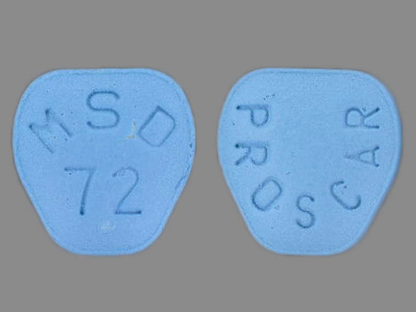 <p>Finasteride</p><p>5-Alpha-Reductase Inhibitors</p><p>Hair Loss </p>