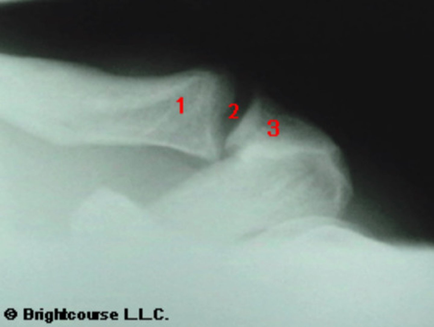 <p>What is being indicated by the number 2?</p>