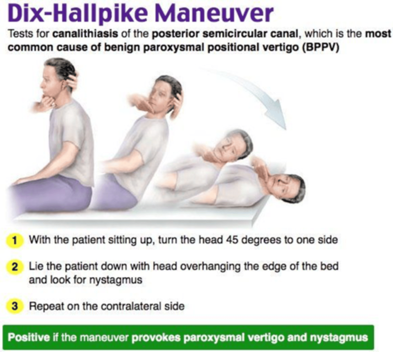 <p>DIX HALLPIKE MAOUVRE</p>