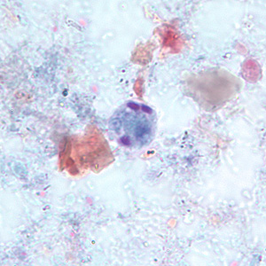 <p>smaller than E.histolytica</p>