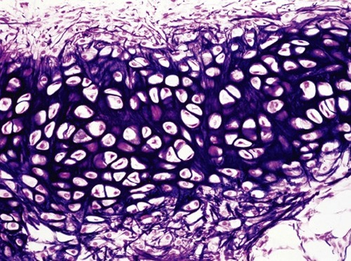 <p>cartilage with abundant elastic fibers</p><ul><li><p>characterized by a matrix rich in elastic fibers, allowing it to <strong>bend and recoil without losing its original shape.</strong></p></li></ul><ul><li><p>gives rigid support as well as flexibility</p></li><li><p>found in <strong>external</strong> construction of the <strong>ear</strong></p></li></ul><p></p>