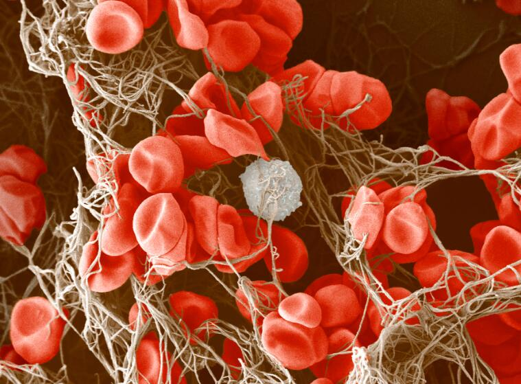 <p><strong><mark data-color="#6b0d0d" style="background-color: #6b0d0d; color: inherit">Blood clotting</mark></strong> <strong><em>prevents pathogens from entering the body through wounds</em></strong> by forming a mesh of fibrin around red blood cells, sealing the cut.</p>