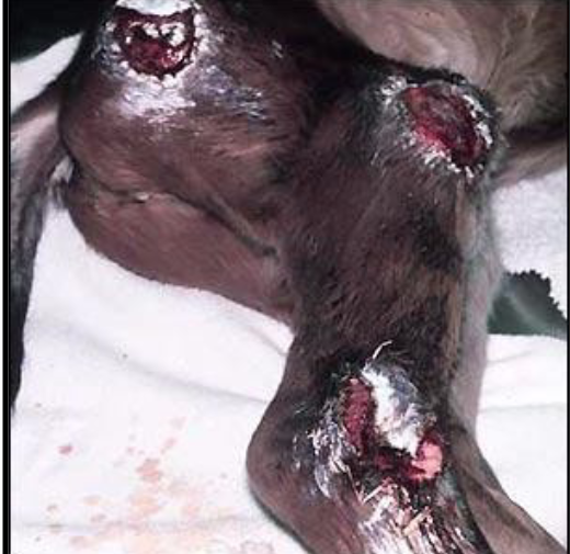 <p>what dis and what are treatments/prevention</p>