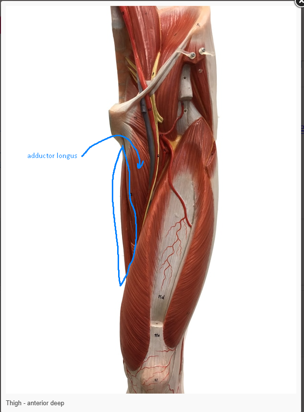 <p>What is the action of the muscle circled&nbsp;</p>