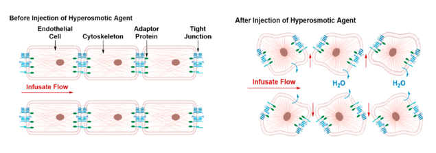 <ul><li><p>Causing osmotic disruption which shrinks the endothelial cells and disrupting the tight junctions to allow molecules to pass through</p></li><li><p><span>The disruption can be also the outcome during inflammation, hypertension and hypoxia</span></p></li><li><p>The shortcomings for the invasive procedures include:</p><ul><li><p>The techniques are not cost effective and include anaesthesia and hospitalization.</p></li><li><p>It may lead to the spread of tumour cells</p></li><li><p>Another outcome could be a permeant damaged in the brain tissue</p></li></ul></li><li><p>First picture shows tight junctions not allowing anything to pass, second picture shows tight junctions opening</p></li></ul><p></p>