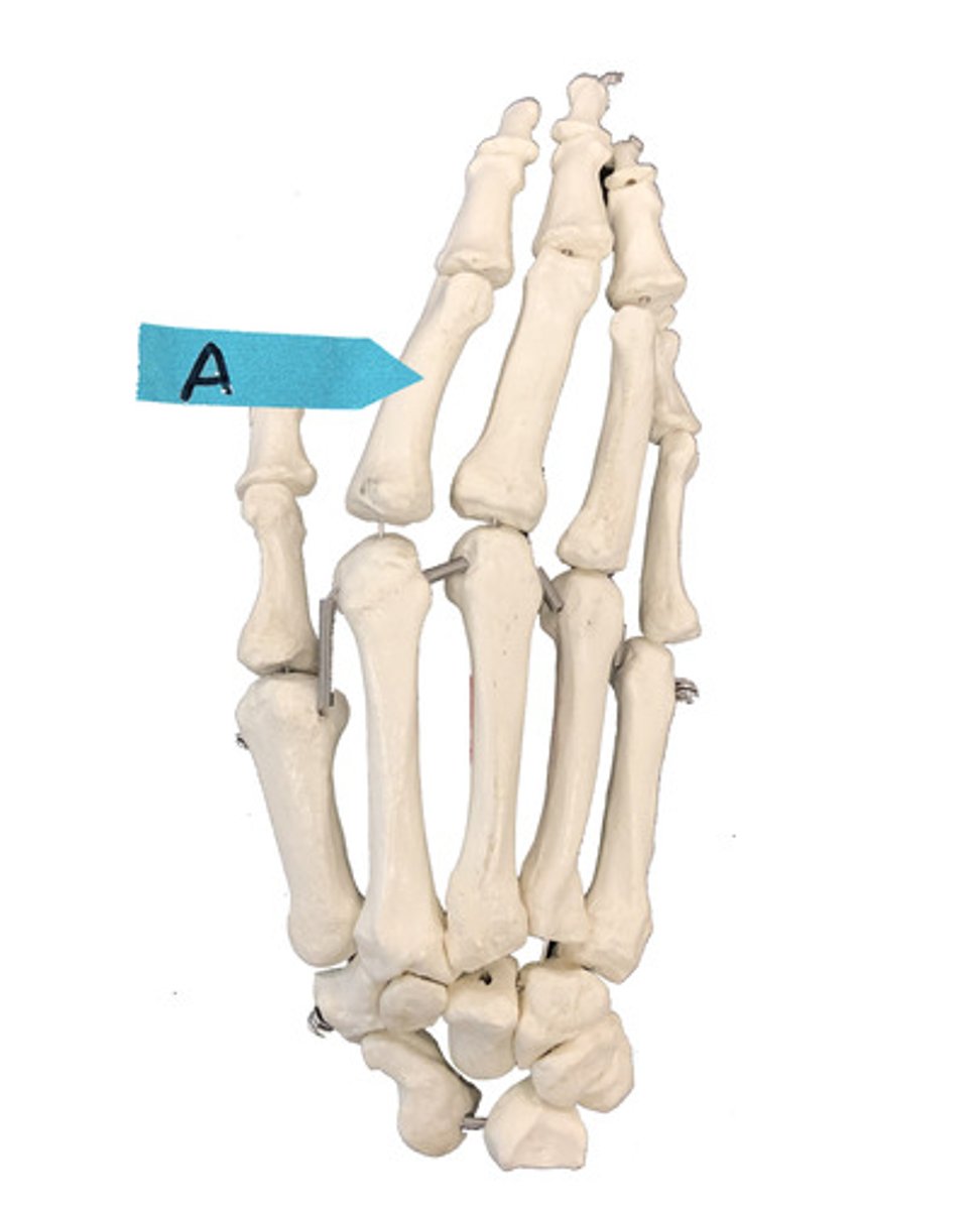 <p>Identify the bone (be specific).</p>
