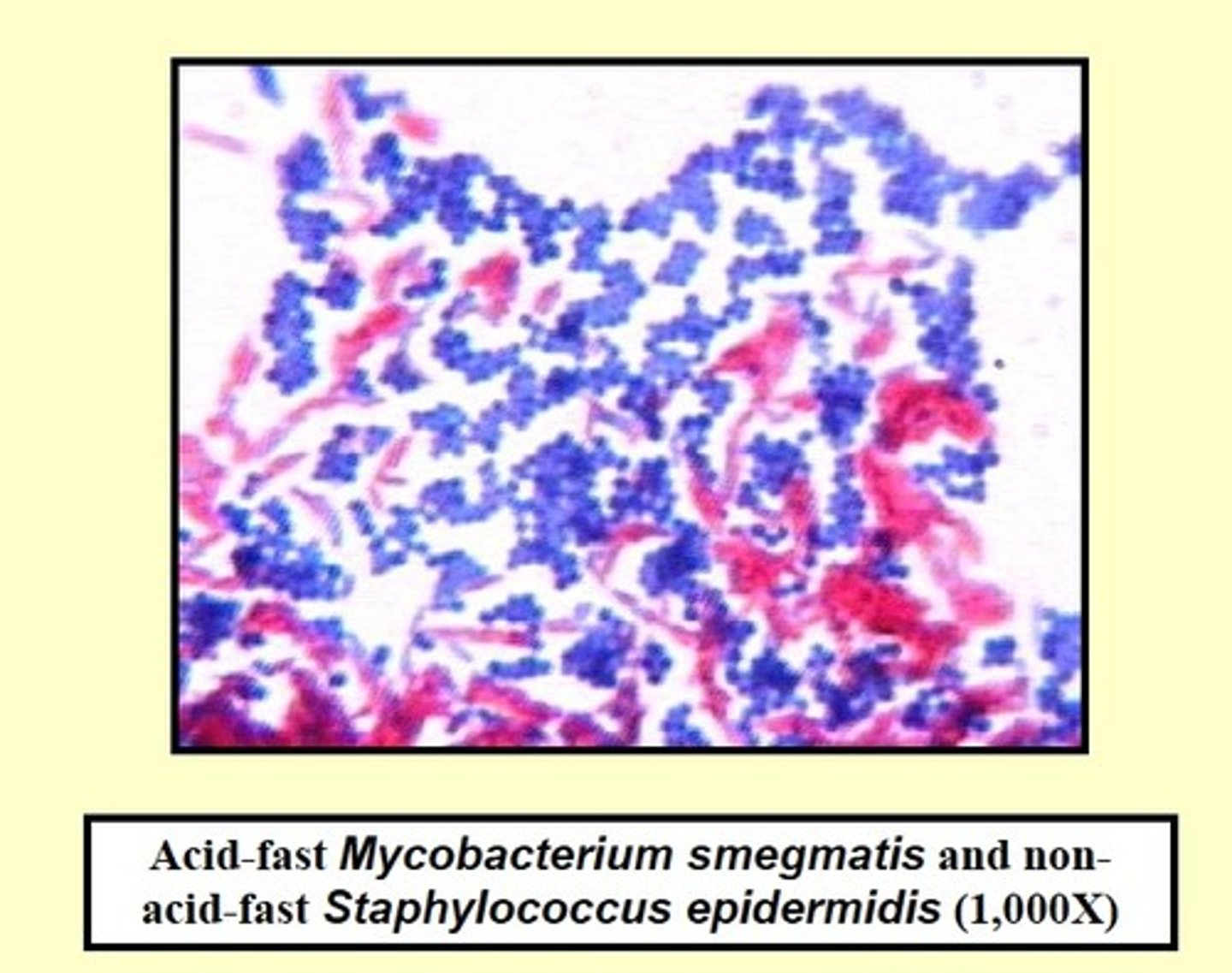<p>Green or blue depending on the counterstain</p>