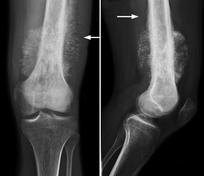 <p>Bones around knee</p>