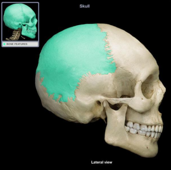 <p>What bone is this?</p>