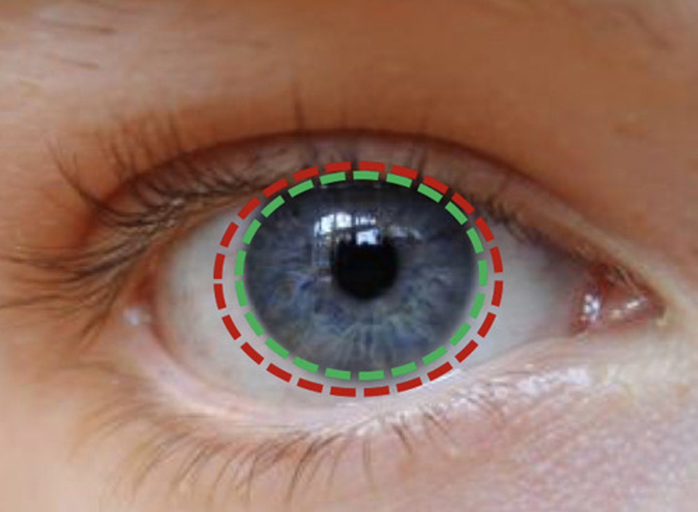 <p>smallest lymphatic vessels that encircle the cornea</p>