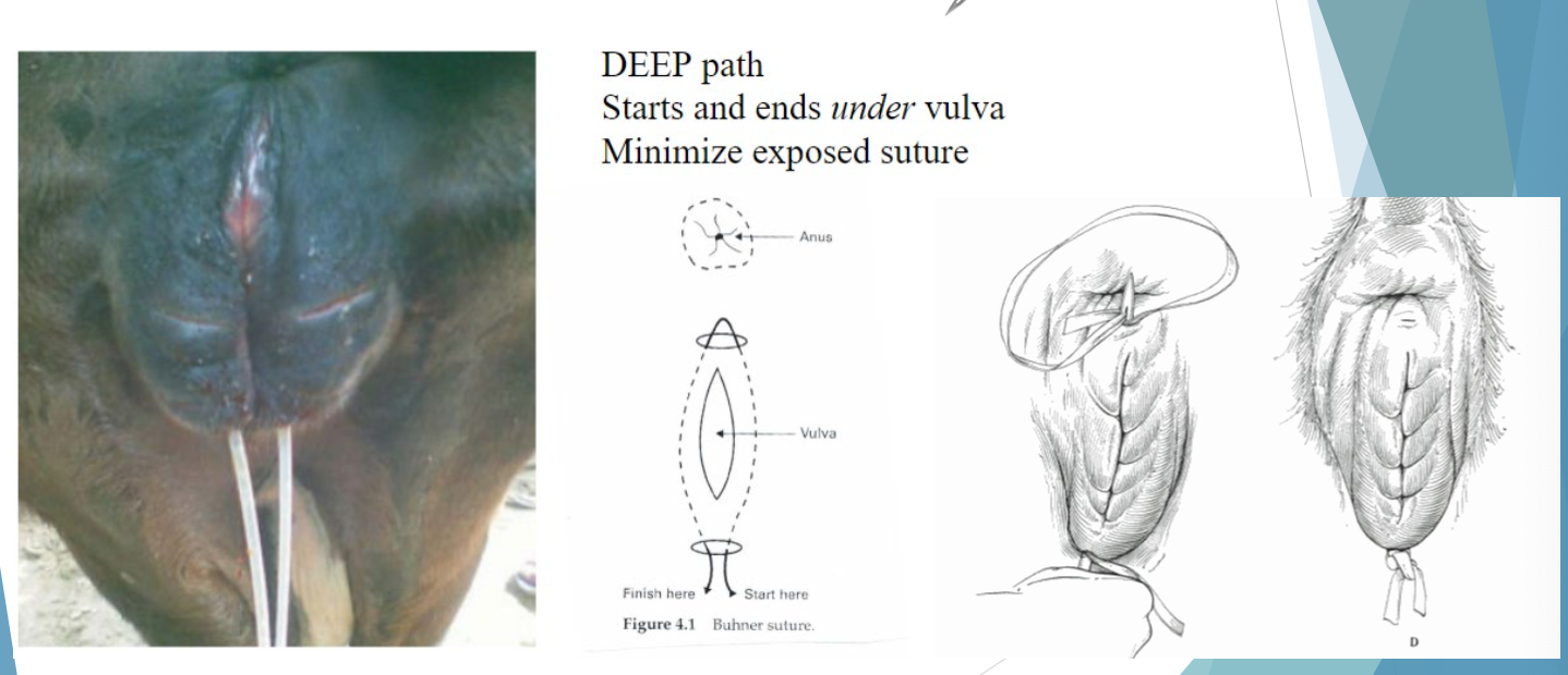 <p>DEEP path</p><p>starts and ends <em>under</em> the vulva</p><p>minimize exposed suture</p>