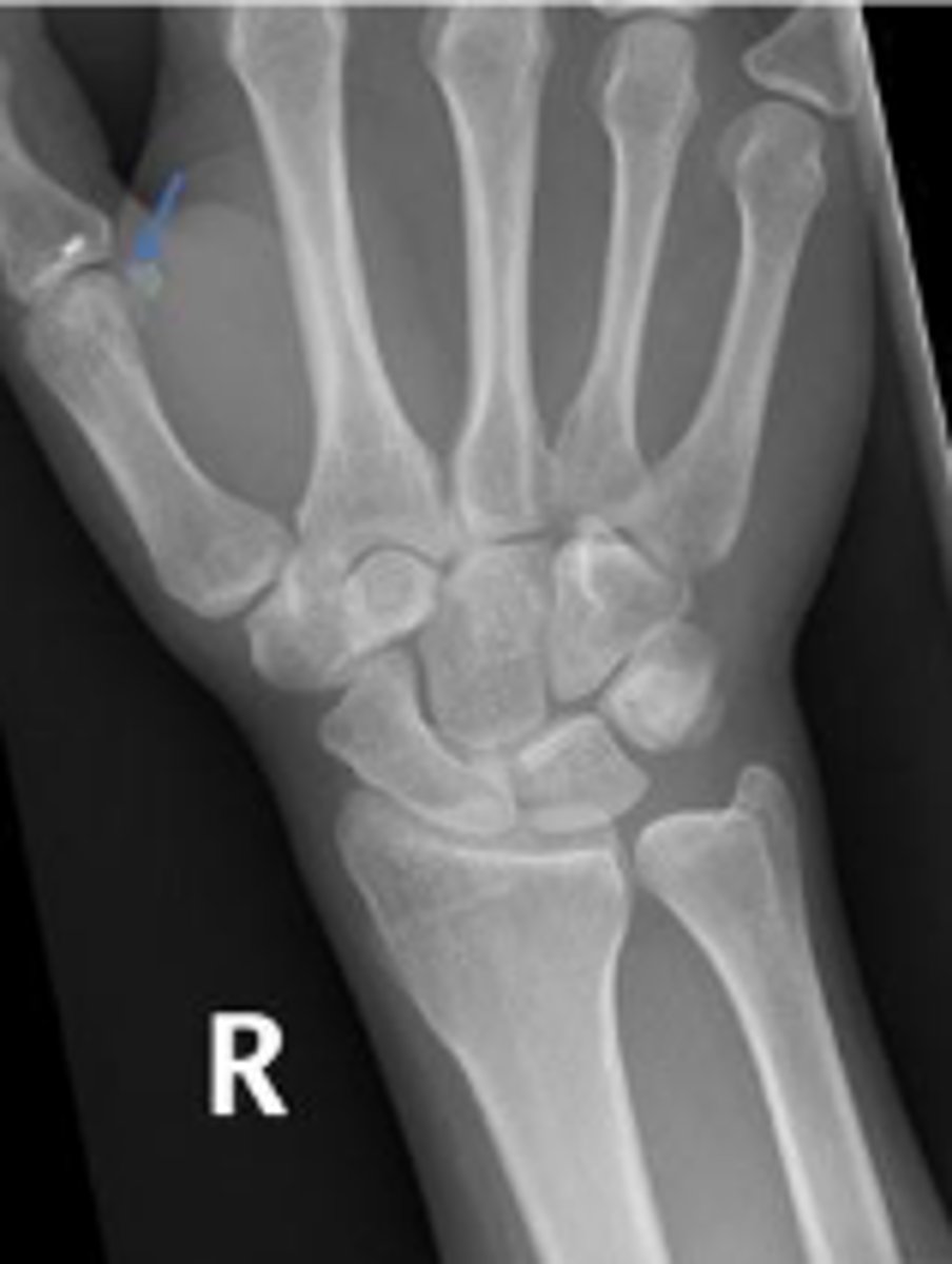 <p>What is the arrow pointing to?</p>