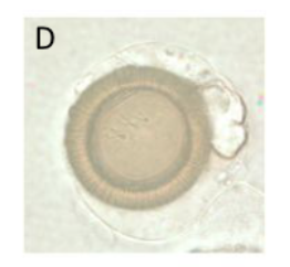 <p>What parasite does this egg belong to?</p>