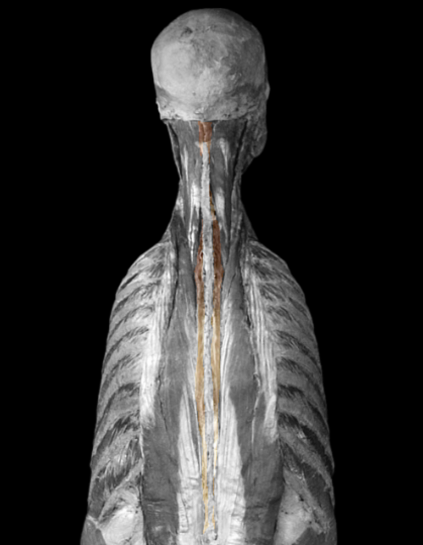 <p>What muscle is this?</p>