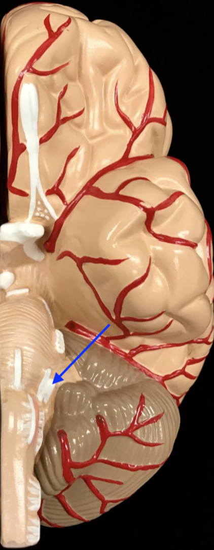 <p>What is the cranial nerve and roman numeral?</p>