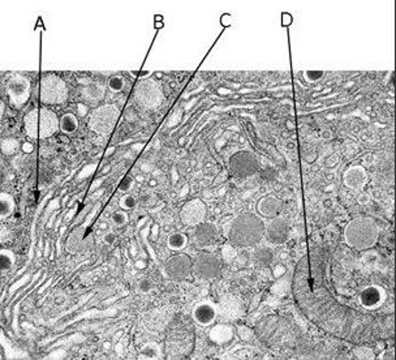 <p>A) A Golgi body's cis face</p><p>B) A Golgi body's trans face</p><p>C) A vesicle budding from the trans face of a Golgi body</p><p>D) A mitochondrion</p>