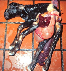<p>This hereditary condition of the fetus can be a cause of dystocia, what is it called?</p>