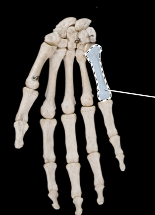 <p>Bones of the hand, anterior view, right side</p>