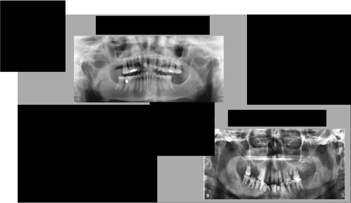 <p>What errors are these?</p>