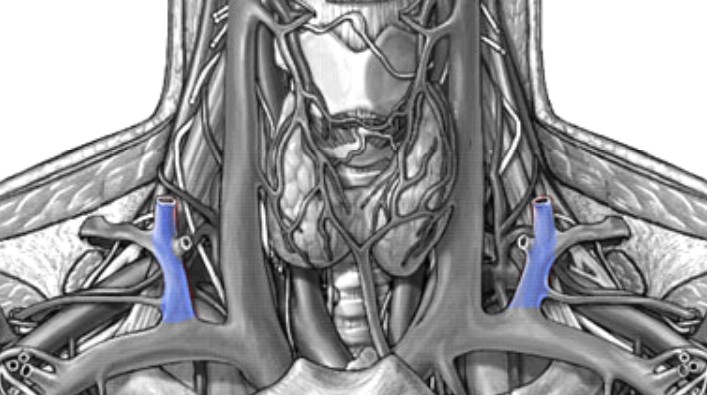 <p>Which veins:</p><ul><li><p>Extends superiorly from subclavian vein</p></li><li><p>Lateral &amp; superficial to internal jugular vein</p></li></ul><p></p>