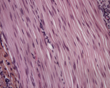 <p>Involuntary and located in areas such as blood vessels , linings of GI track and urinary bladder</p>