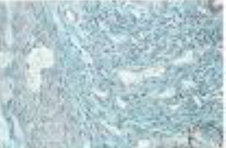 <p>Identifica el tejido</p>