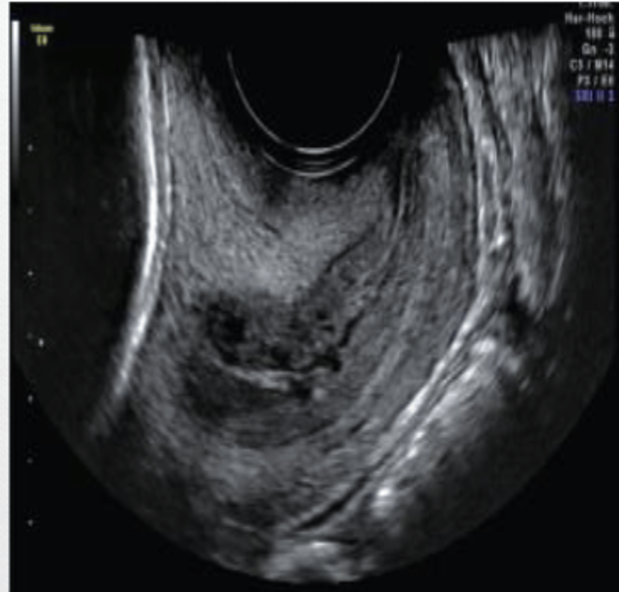 <p>the central lesion could be described as ______.</p>