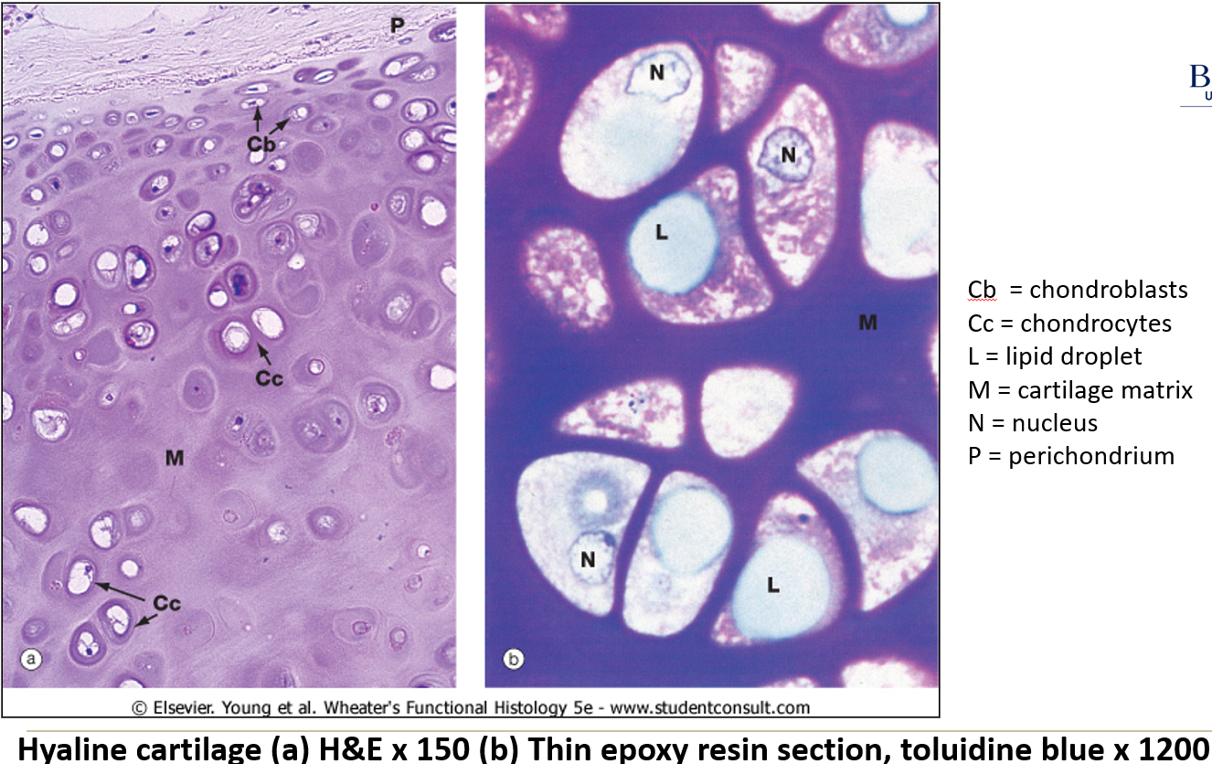 <ol><li><p><strong>Chondrocytes:</strong> Cells located in lacunae, often with lipid droplets or vacuoles.</p></li><li><p><strong>Avascular:</strong> Lacks blood vessels, so oxygen diffuses through the matrix.</p></li><li><p><strong>Perichondrium:</strong> Dense connective tissue layer around cartilage with flat reserve chondroblasts.</p></li></ol><p></p>