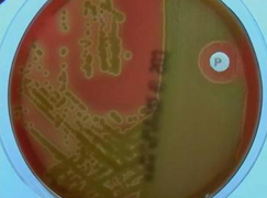 <p>Hemolysis Type?</p>