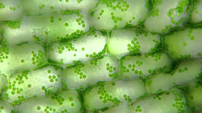 <p>What is the name of the green discoid organelles in the cells below.</p>