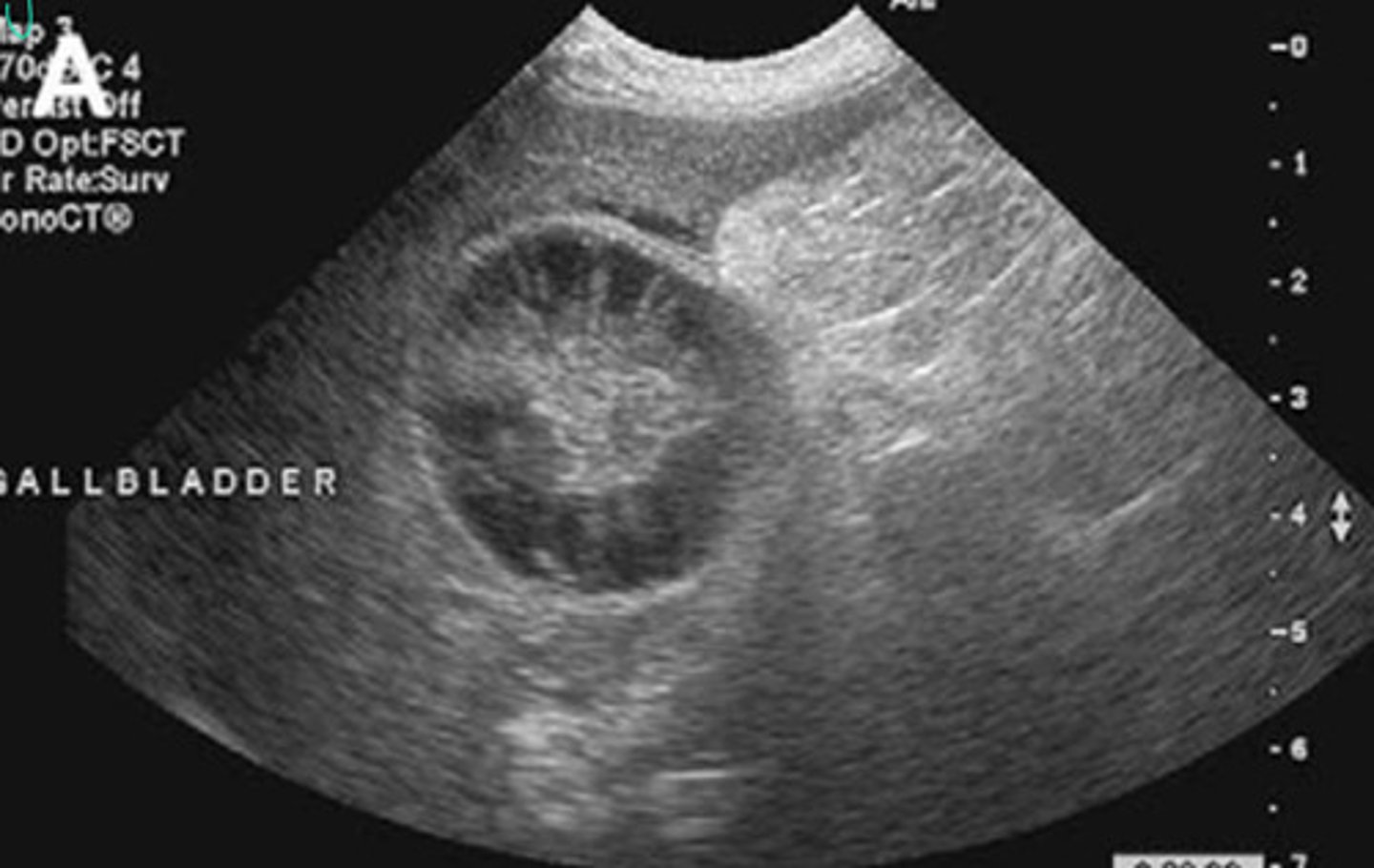 <p>What is going on here? Is this normal or abnormal?</p>