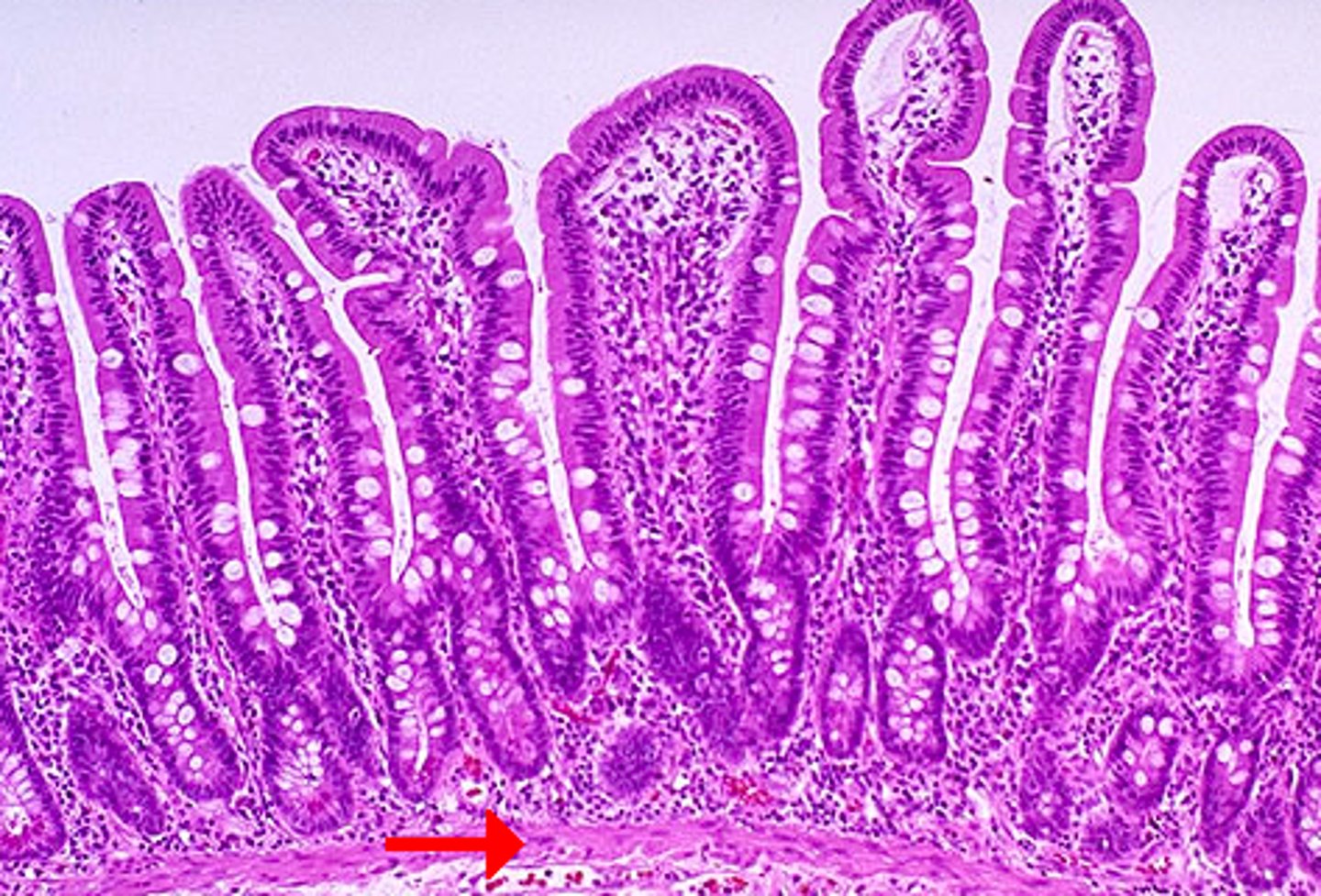 <p>smooth muscle layer forming the deep border of the mucosa in small intestine</p>