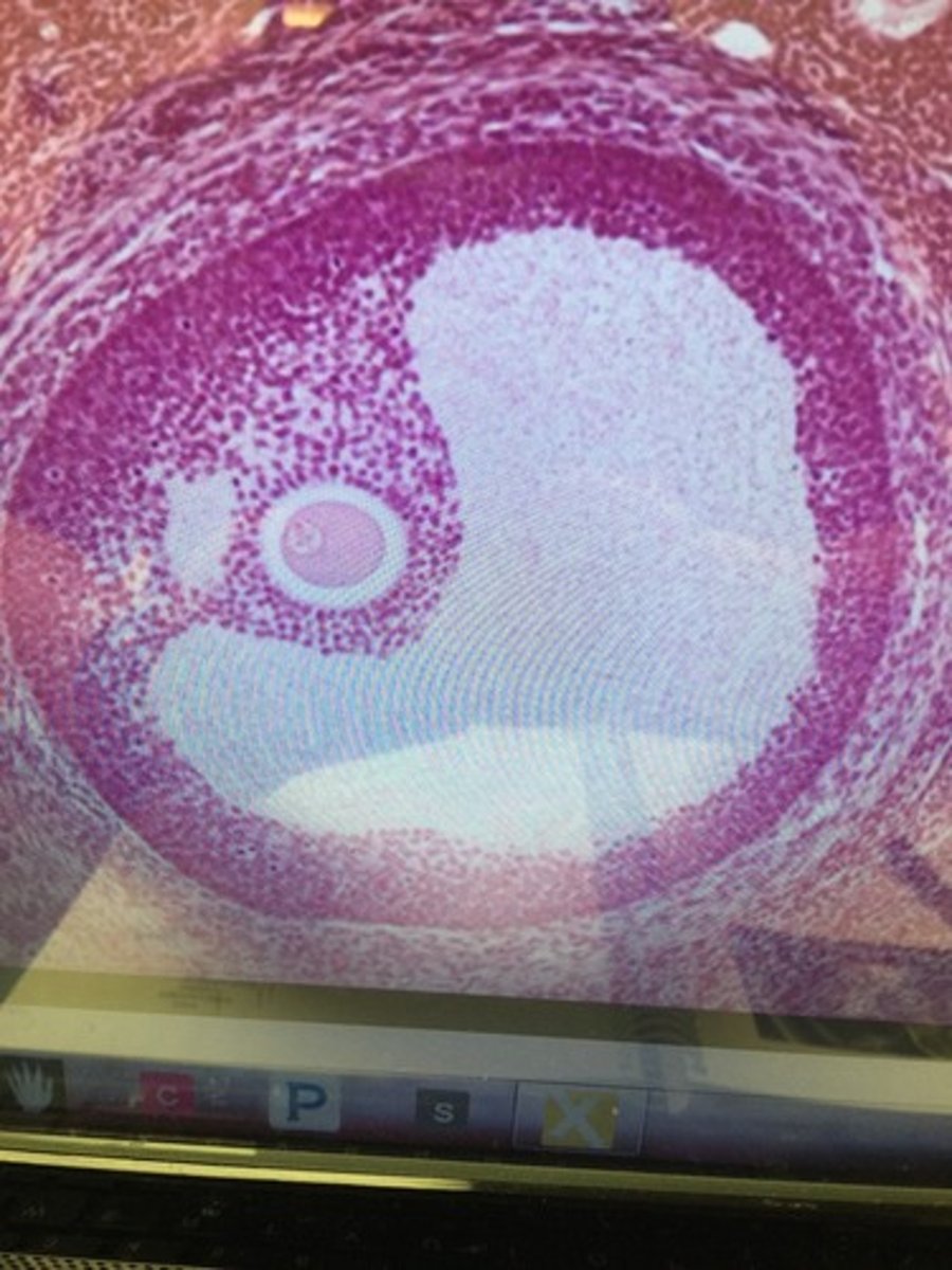<p>As primary follicles continue to mature, they form these structures that are pictured here?</p>