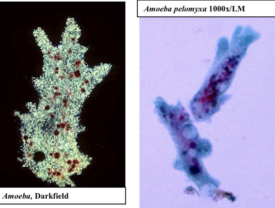 <p>Genus: Amoeba</p>