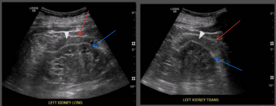 <p>What are the white arrow heads pointing to?</p>