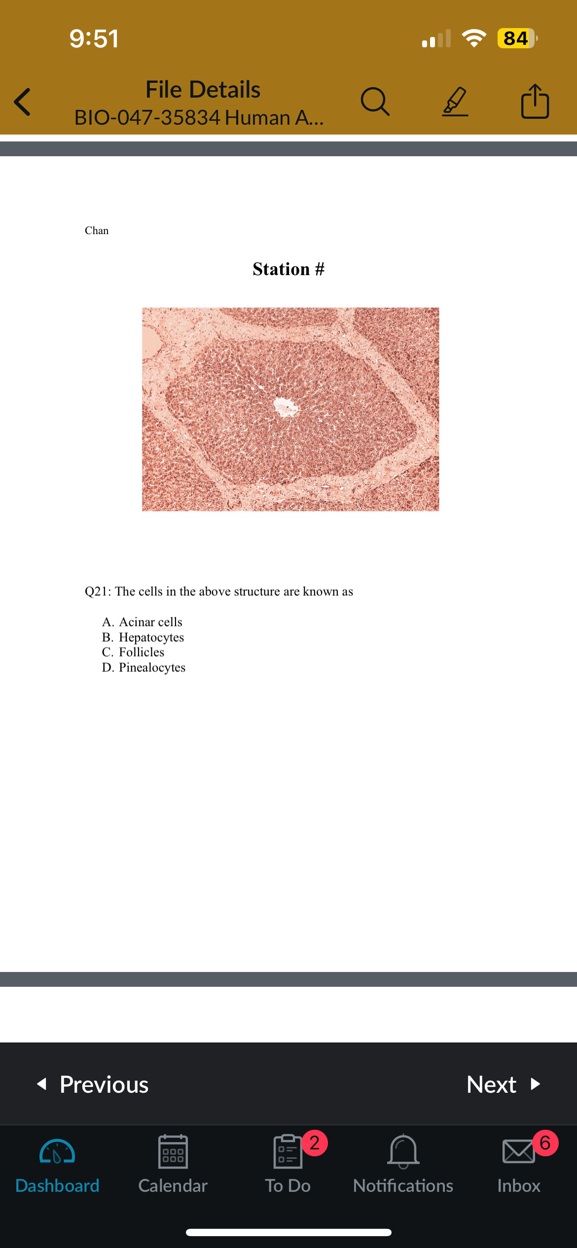 <p>Q21: The cells in the above structure are known as</p>