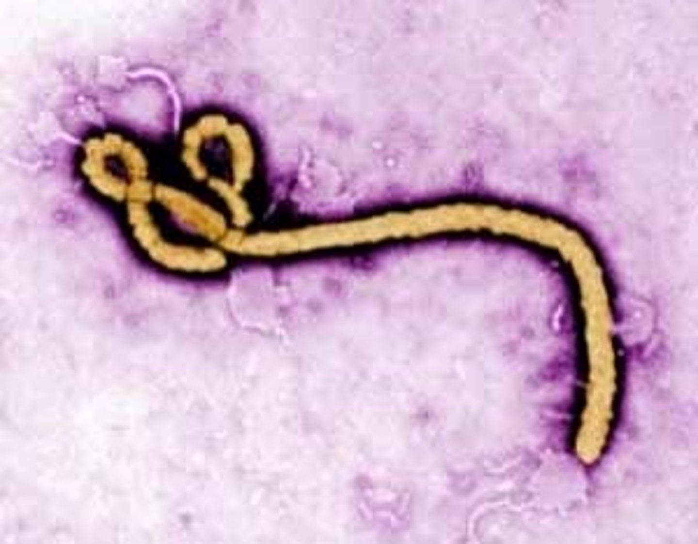 <p>Virus belongs to the Family Filoviridae, genus Ebolavirus, spreads though contaminated surfaces and bodily fluid contact, treatments are fluids and supportive(hospital) care, no vaccine.</p>