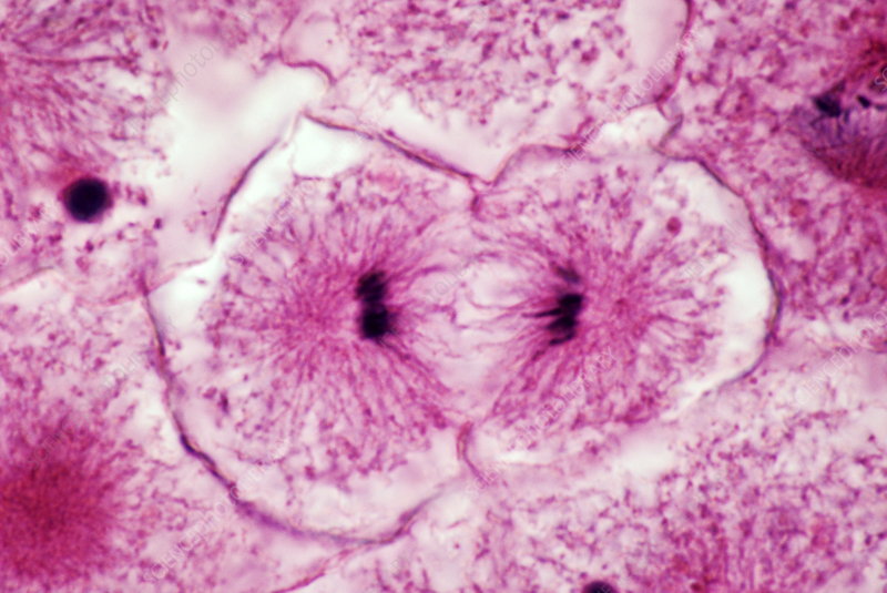 <p>what stage of the cell cycle is being showed here ?</p>