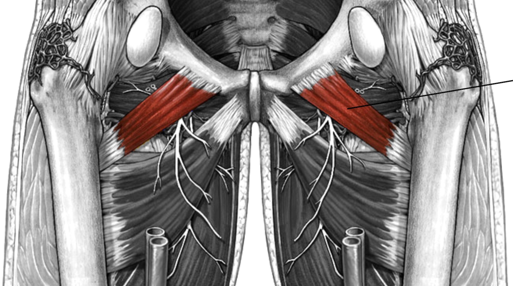 <p>Which muscle of the femur is:</p><ul><li><p>Superior to adductor brevis</p></li><li><p>Action: flex, adducts &amp; medial rot hip</p></li><li><p>Nerve: <span style="color: yellow;">femoral</span></p></li></ul><p></p>